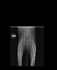 Keva pelvis 2.jpg