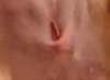 Resize of Incision-6-9-14- 1.jpg