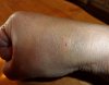 bruise.jpg